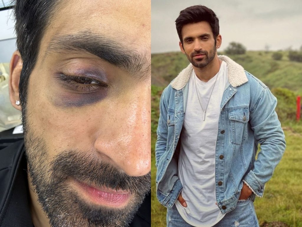 Khatron Ke Khiladi 13: Arjit Taneja injured!